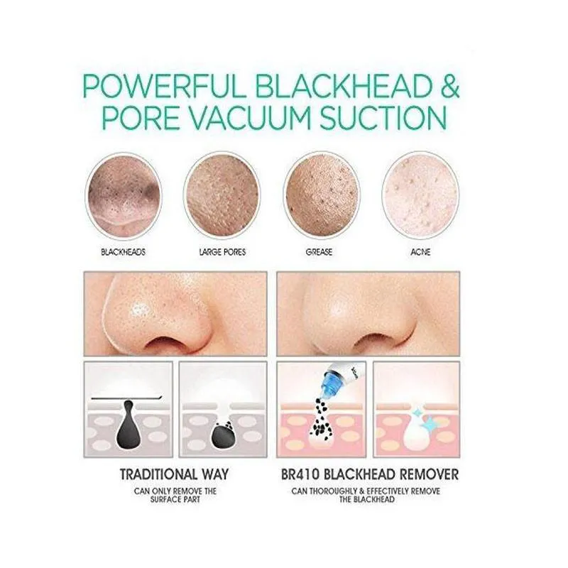 Professional Electric Blackhead Vacuum